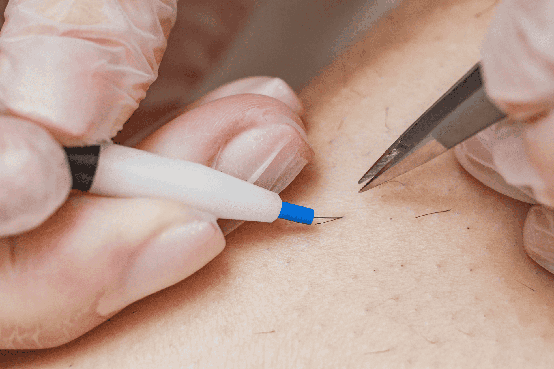 Close-up of hands performing microblading procedure on skin with tweezers and blade.